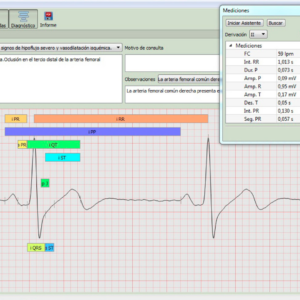 Electrocardiografo Temis Software Easy G